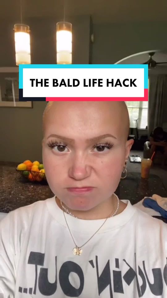 This is the bald life hack #comedy #funny #alopecia #bald