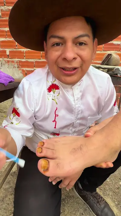 Hongos en los pies, te enseño como eliminar ese mal olor — @mickyteensena