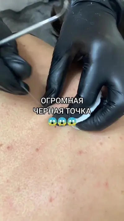Всех чувствительных прошу отойти от экрана😂 что думаете по поводу виде — @kosmetolog_maria_krd