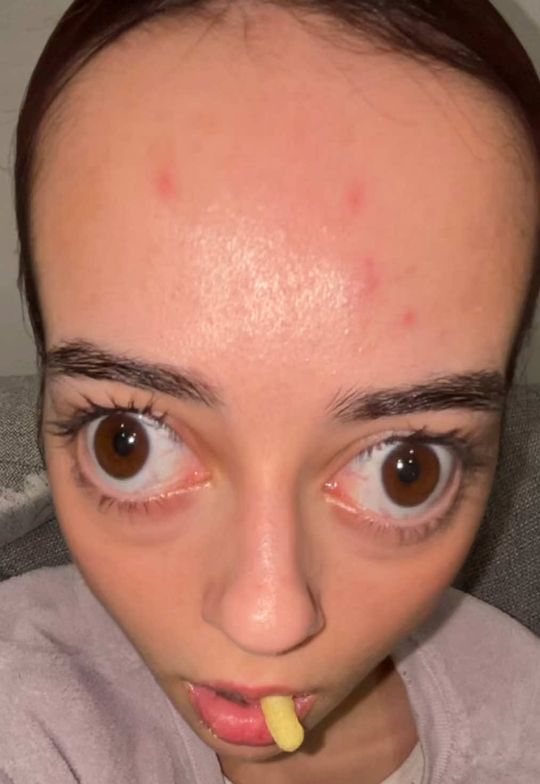😳